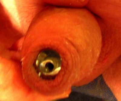 Penis Plug 14mm foreskin closed