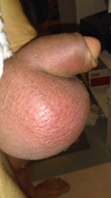 Needin some lotion. skin is sooo freakin tight.