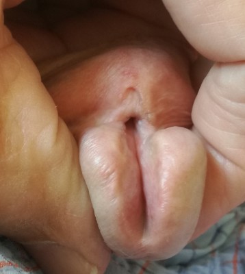 My visible peehole on the penis shaft