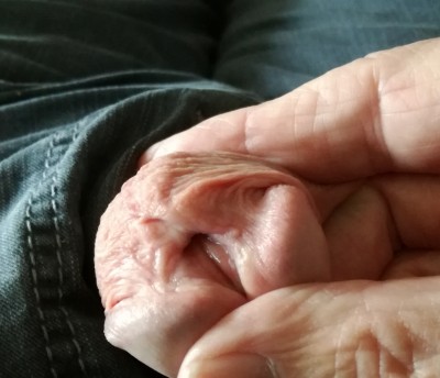 Open peehole