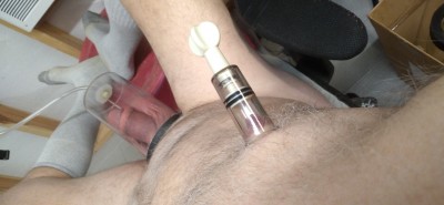 First time nip pumping