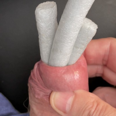 BPH-three-rods.jpg