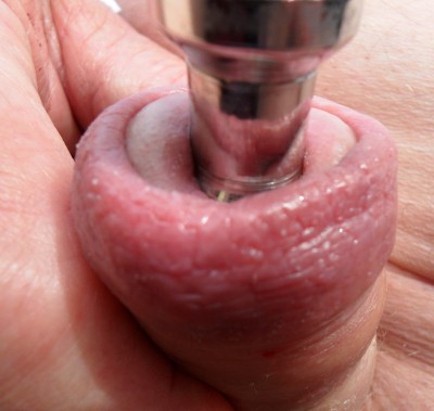 Foreskin closed with 18mm penis plug.