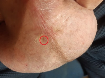 no_bruise1.jpg