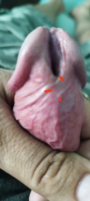 My dick<br />My dick