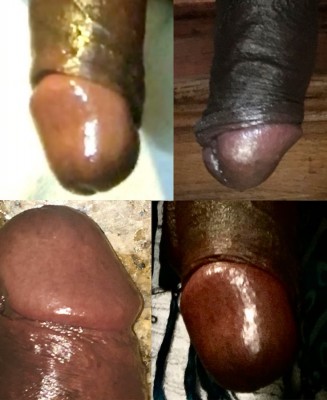 penis heads erect-COLLAGE.jpeg