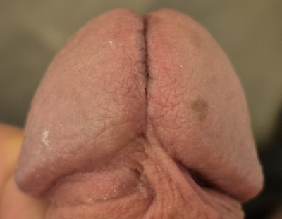 Vorher