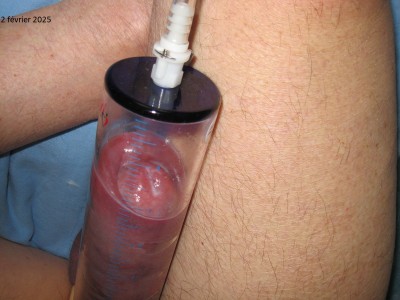 jmlepoil 2025 2 2 fév 1.JPG