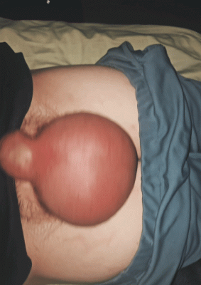 GIF