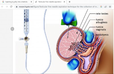 Testicle x-section.