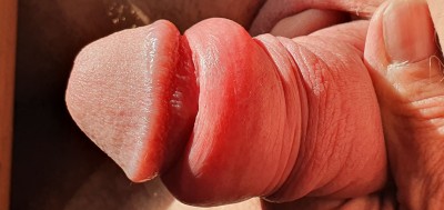 cock head