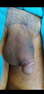 cock in sack 2